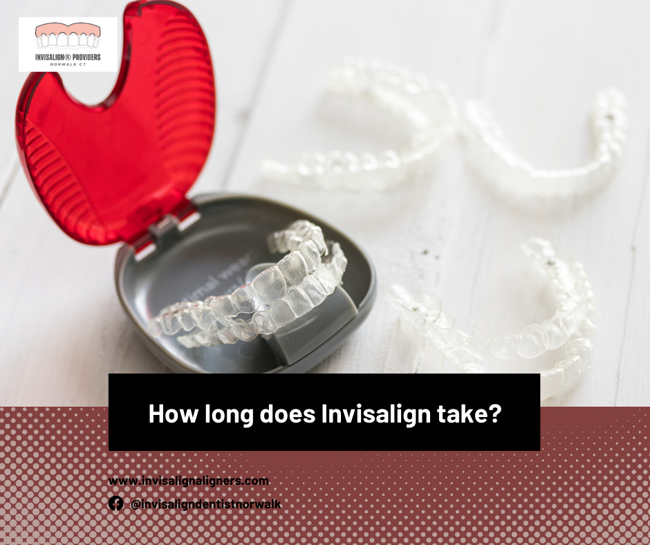 How Long Does Invisalign Take To Straighten Teeth?