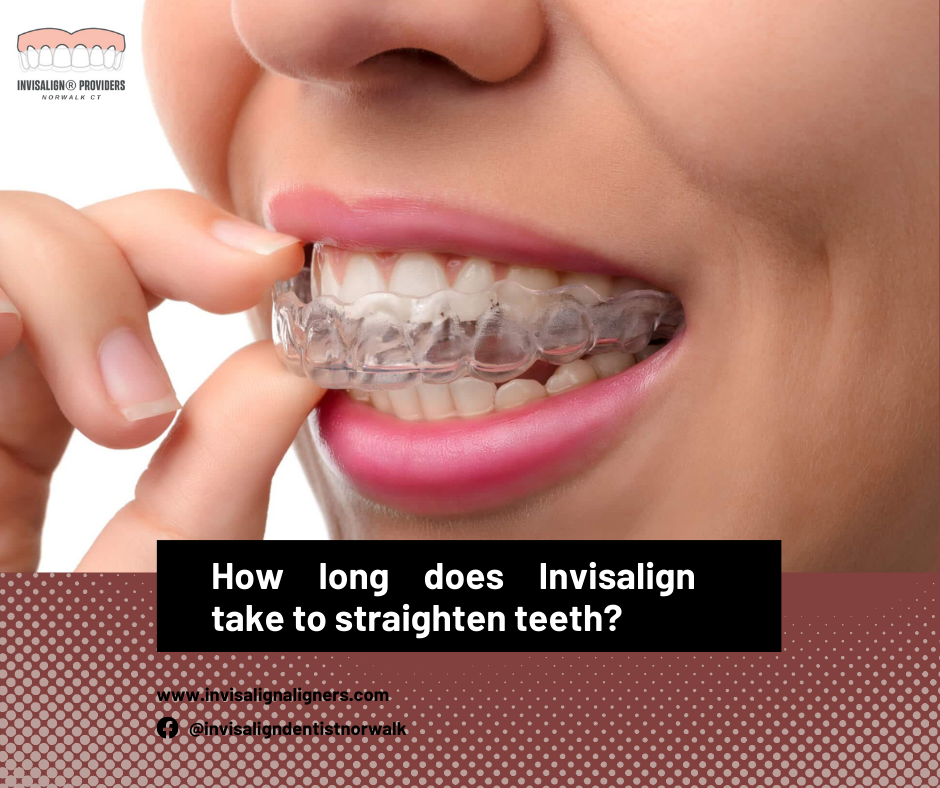 How Long Does Invisalign Take to Work?