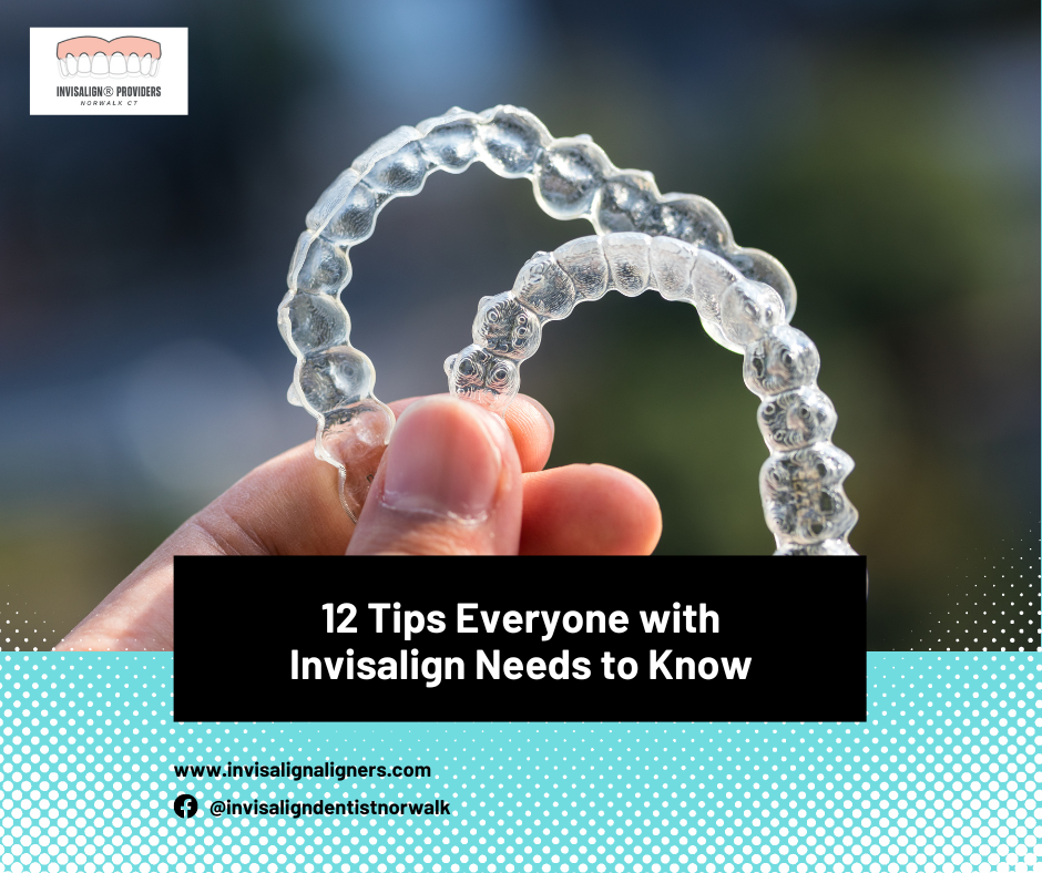 12 Tips Everyone With Invisalign Needs To Know Invisalign® Provider